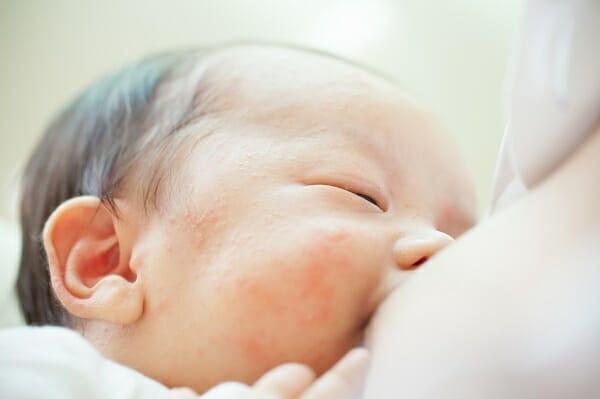 母乳育児の悩み 赤ちゃんが片方の母乳を飲まない Amoma